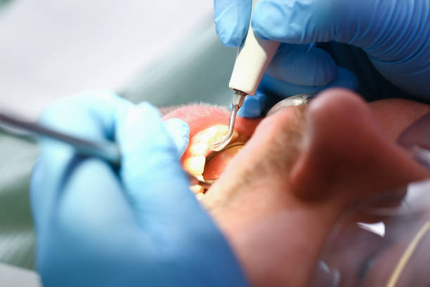 Best Emergency Dental Care for Sports Injuries in Snowflake, AZ